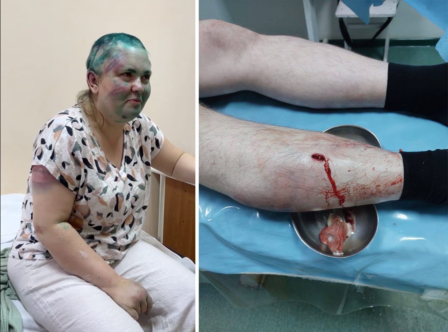 «Они четко понимали пределы, за которые запрещено заходить». Милашина и Немов рассказали, как их избивали и заставляли есть землю