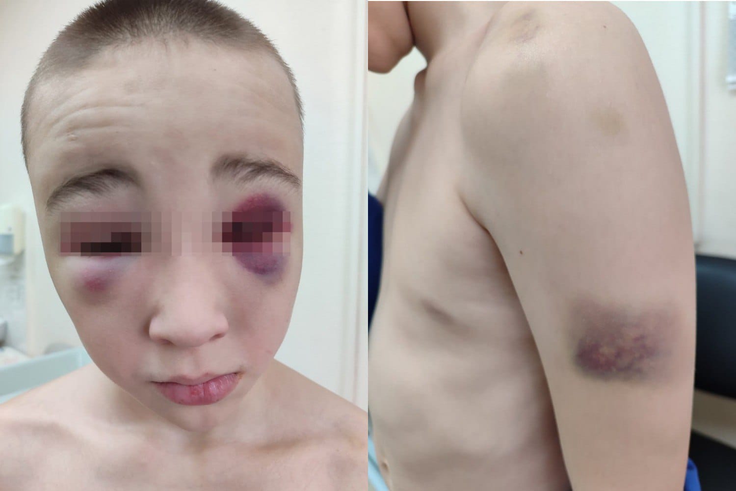 Бывший участник войны в Украине разбил 10-летнему мальчику голову палкой в военно-патриотическом центре